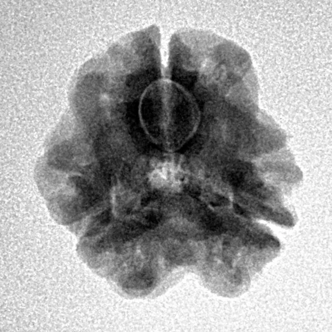 3 Mukhi Rudraksha 18.4mm 2.32gm - Inverse xray
