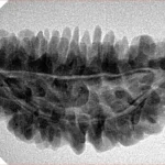 1 Mukhi Rudraksha 36.7mm 4.87gm - Inverse xray