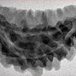 1 Mukhi Rudraksha 36.3mm 5gm - Inverse xray