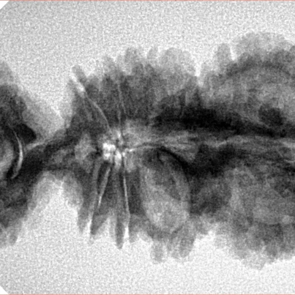 18 Mukhi Trijuti 40.4mm 5.81gm - Origin: Nepal - Inverse xray