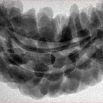 1 Mukhi Rudraksha 37.8mm 6.53gm - Inverse xray