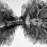 10 Mk Gaurishankar 43.8mm 11gm - Inverse xray