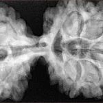 10 Mk Gaurishankar 43.8mm 11gm - Xray