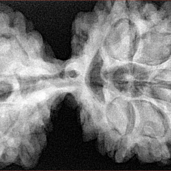 10 Mk Gaurishankar 43.8mm 11gm - Xray