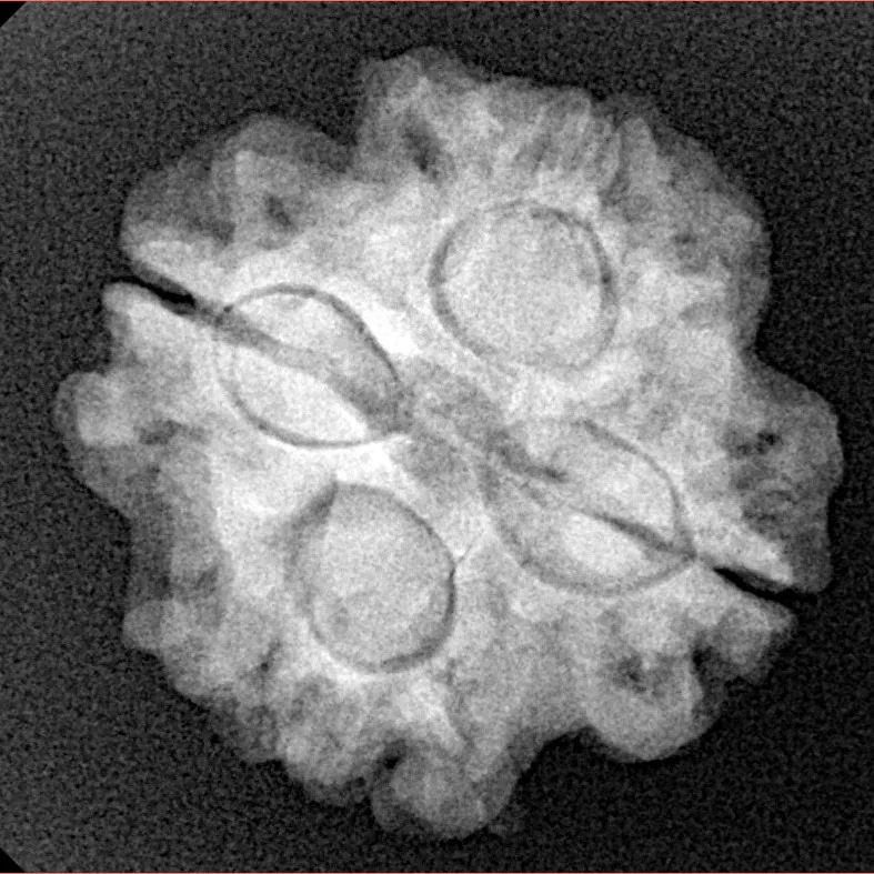 4 Mukhi Rudraksha 21.5mm 4.43gm - Xray