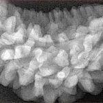 1 Mukhi Rudraksha 34mm 5.9gm - Xray