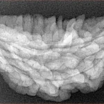 1 Mukhi Rudraksha 37.2mm 4.83gm - Xray