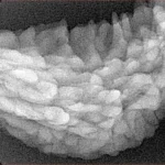 1 Mukhi Rudraksha 36.6mm 4.82gm - Xray