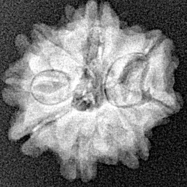 8 Mukhi Rudraksha 19.4mm 2.33gm - Xray