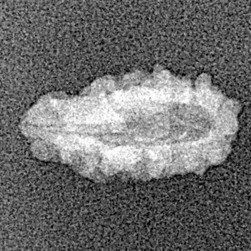 1 Mukhi Rudraksha 14.6mm 0.34gm - Xray