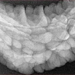 1 Mukhi Rudraksha 36.3mm 6.18gm - Xray