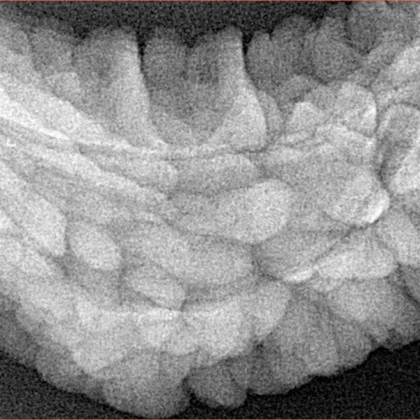 1 Mukhi Rudraksha 36.3mm 6.18gm - Xray