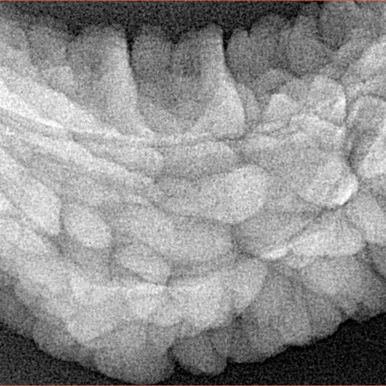 1 Mukhi Rudraksha 36.3mm 6.18gm - Xray