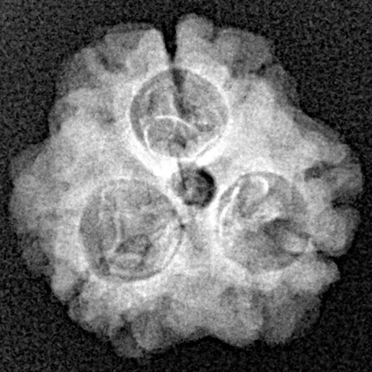 3 Mukhi Rudraksha 19.4mm 1.84gm - Xray
