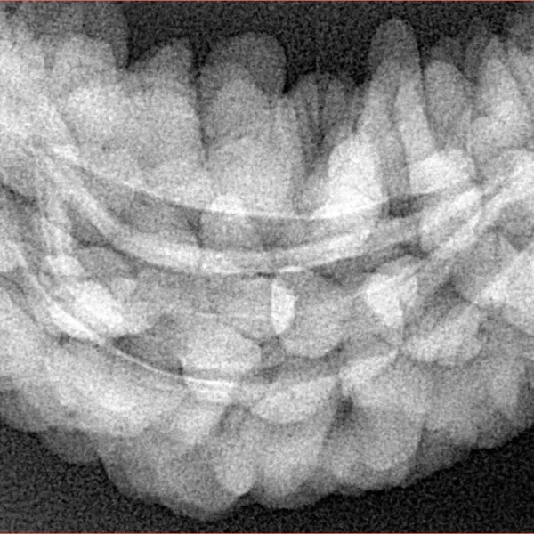 1 Mukhi Rudraksha 37.8mm 6.53gm - Xray