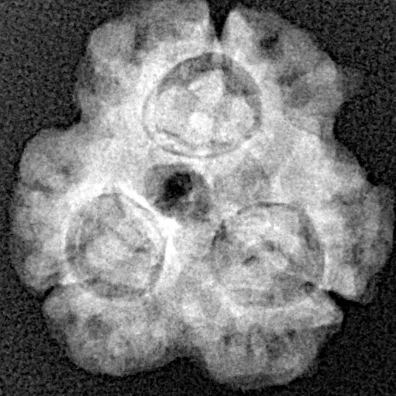 3 Mukhi Rudraksha 20mm 2.42gm - Xray