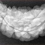 1 Mukhi Rudraksha 37.3mm 5.6gm - Xray
