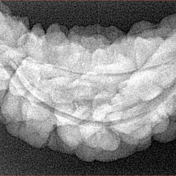 1 Mukhi Rudraksha 37.3mm 5.6gm - Xray