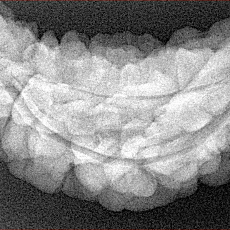 1 Mukhi Rudraksha 37.3mm 5.6gm - Xray