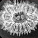 13 Mukhi Rudraksha 29.2mm 4.93gm - Xray