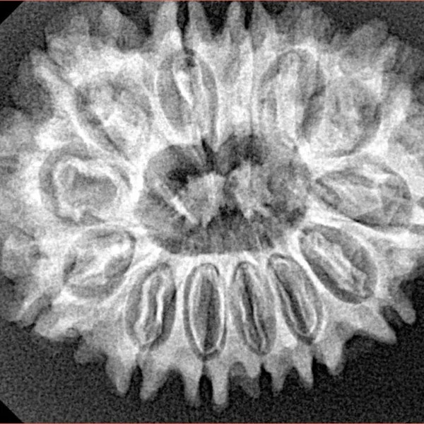 13 Mukhi Rudraksha 29.2mm 4.93gm - Xray