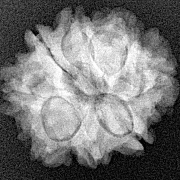8 Mukhi Rudraksha 21.2mm 3.07gm - Xray