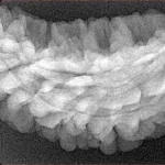 1 Mukhi Rudraksha 35mm 4.84gm - Xray