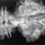 15 Mukhi Trijuti 54.5mm 12.31gm - Xray