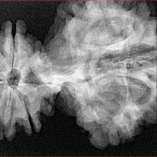 15 Mukhi Trijuti 54.5mm 12.31gm - Xray