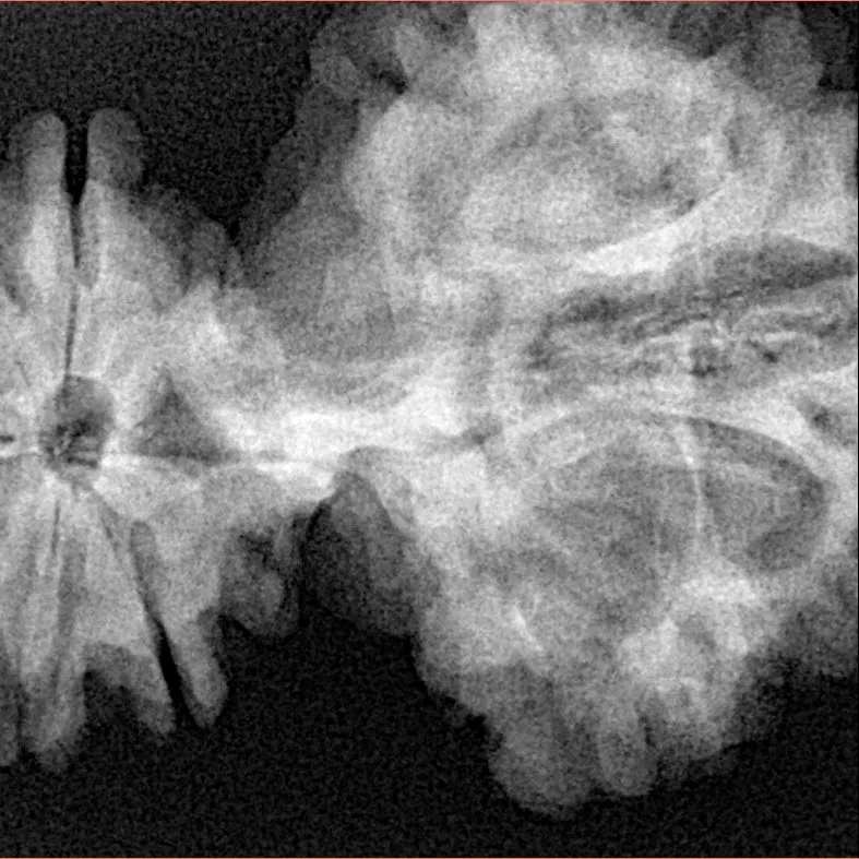 15 Mukhi Trijuti 54.5mm 12.31gm - Xray