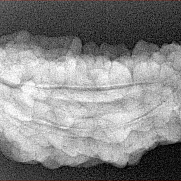 1 Mukhi Rudraksha 37.6mm 5.52gm - Xray