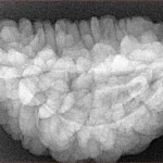 1 Mukhi Rudraksha 32.2mm 6.25gm - Xray