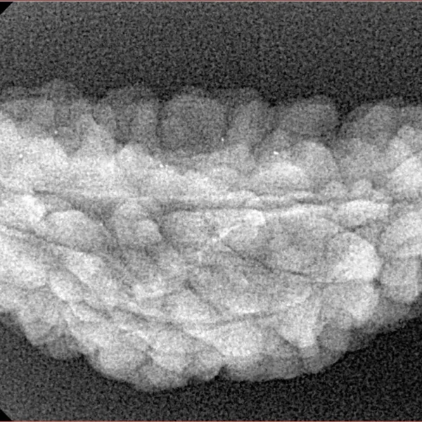 1 Mukhi Rudraksha 36.9mm 3.7gm - Xray