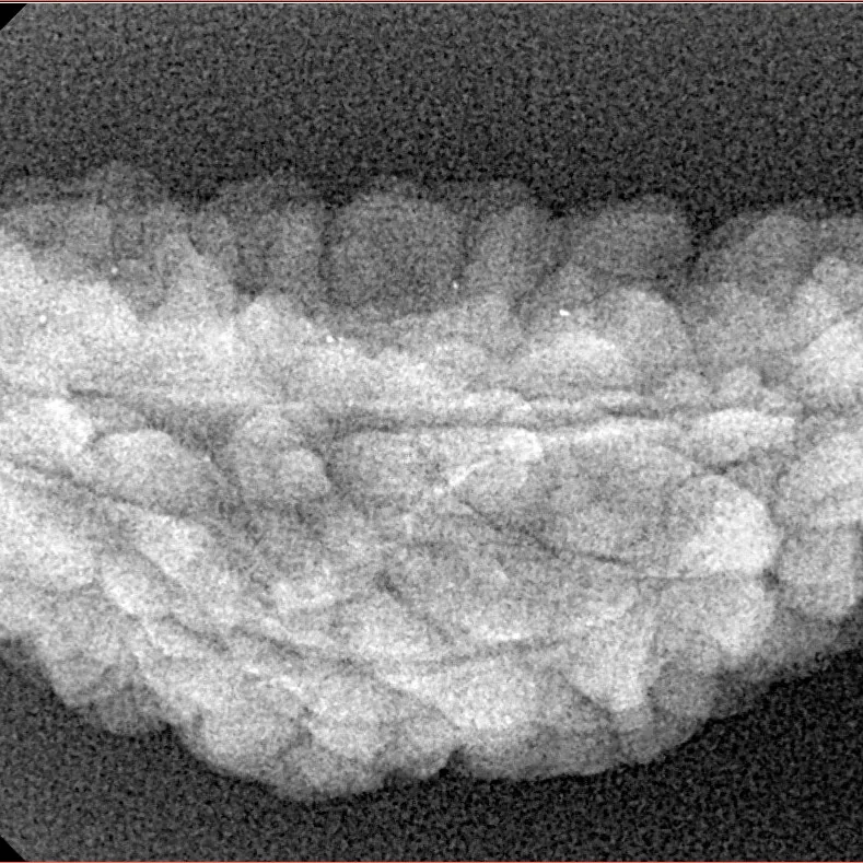 1 Mukhi Rudraksha 36.9mm 3.7gm - Xray