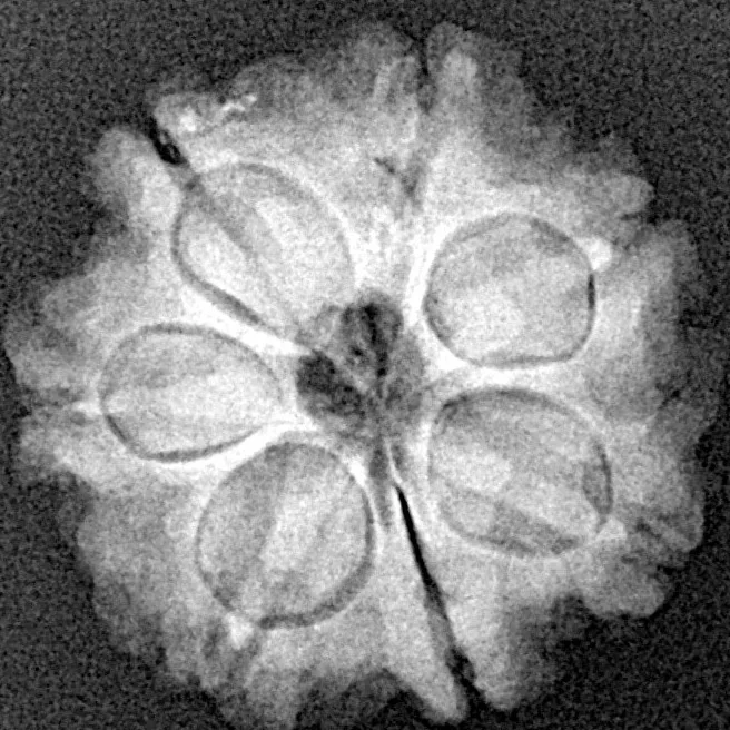 7 Mukhi Rudraksha 20.4mm 3.15gm - Xray