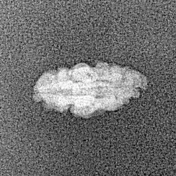 1 Mukhi Rudraksha 13.1mm 0.22gm - Xray