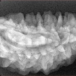 1 Mukhi Rudraksha 34mm 4.74gm - Xray