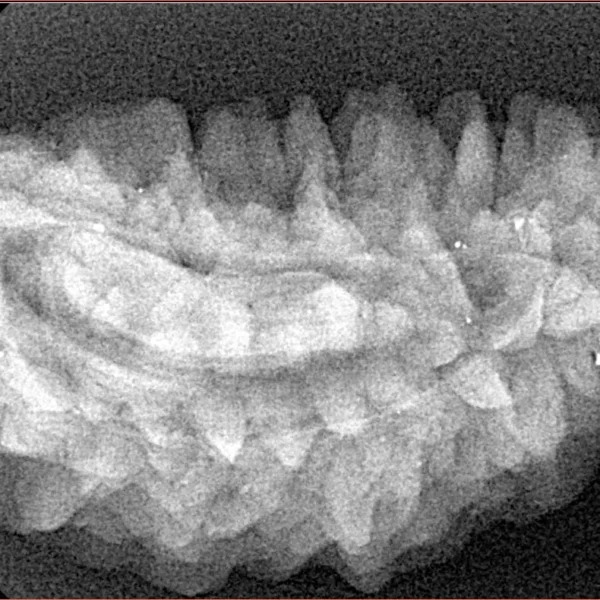 1 Mukhi Rudraksha 34mm 4.74gm - Xray