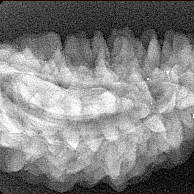 1 Mukhi Rudraksha 34mm 4.74gm - Xray