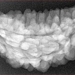 1 Mukhi Rudraksha 36.2mm 5.5gm - Xray