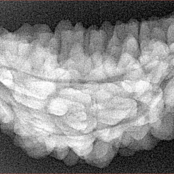 1 Mukhi Rudraksha 36.2mm 5.5gm - Xray