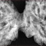 9 MK Gaurishankar 46mm 10.67gm - Xray