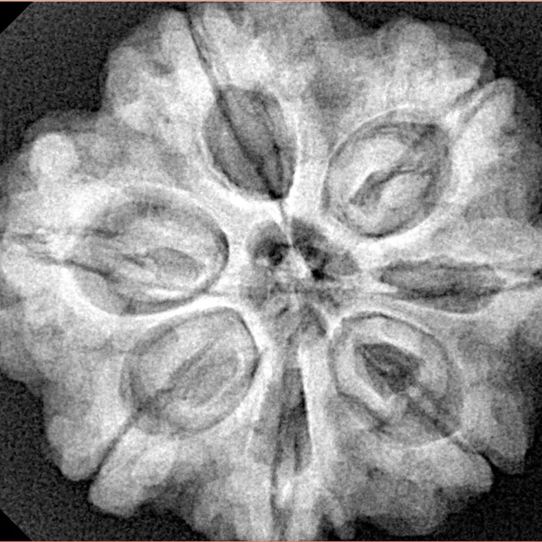 7 Mukhi Rudraksha 28.3mm 7gm - Origin: Nepal - Xray