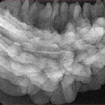1 Mukhi Rudraksha 38.1mm 5.27gm - Xray