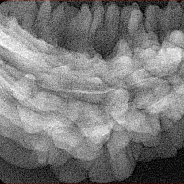 1 Mukhi Rudraksha 38.1mm 5.27gm - Xray