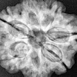 7 Mukhi Rudraksha 26.7mm 6gm - Xray