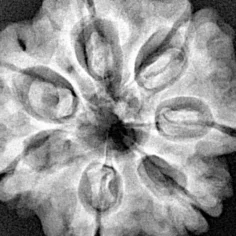 7 Mukhi Rudraksha 27.1mm 6.58gm - Xray