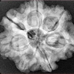 7 Mukhi Rudraksha 27.1mm 5.85gm - Xray