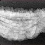 1 Mukhi Rudraksha 37.5mm 5.92gm - Xray