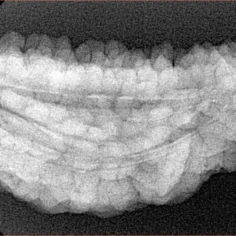 1 Mukhi Rudraksha 37.5mm 5.92gm - Xray